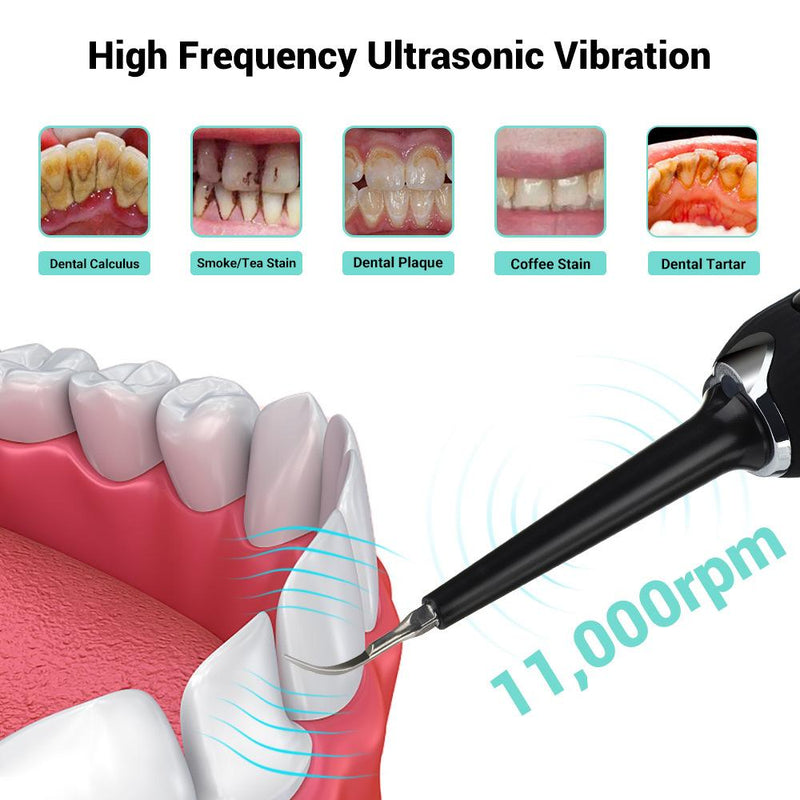 High Frequency Electric Ultrasonic Dental Tartar Plaque Calculus Tooth Remover Set Kits Cleaner with LED Screen Pink